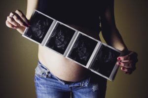 sperm donor rights and responsibilities Brisbane family law firm